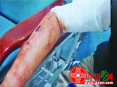 南京火锅店酒精爆炸 9名顾客被烧伤(图)