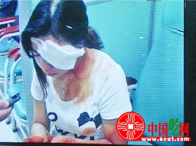 南京火锅店酒精爆炸 9名顾客被烧伤(图)